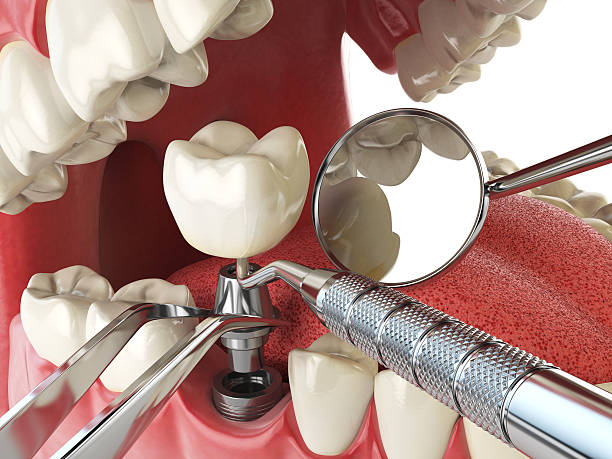 Best Emergency Tooth Extraction in Treasure Lake, PA
